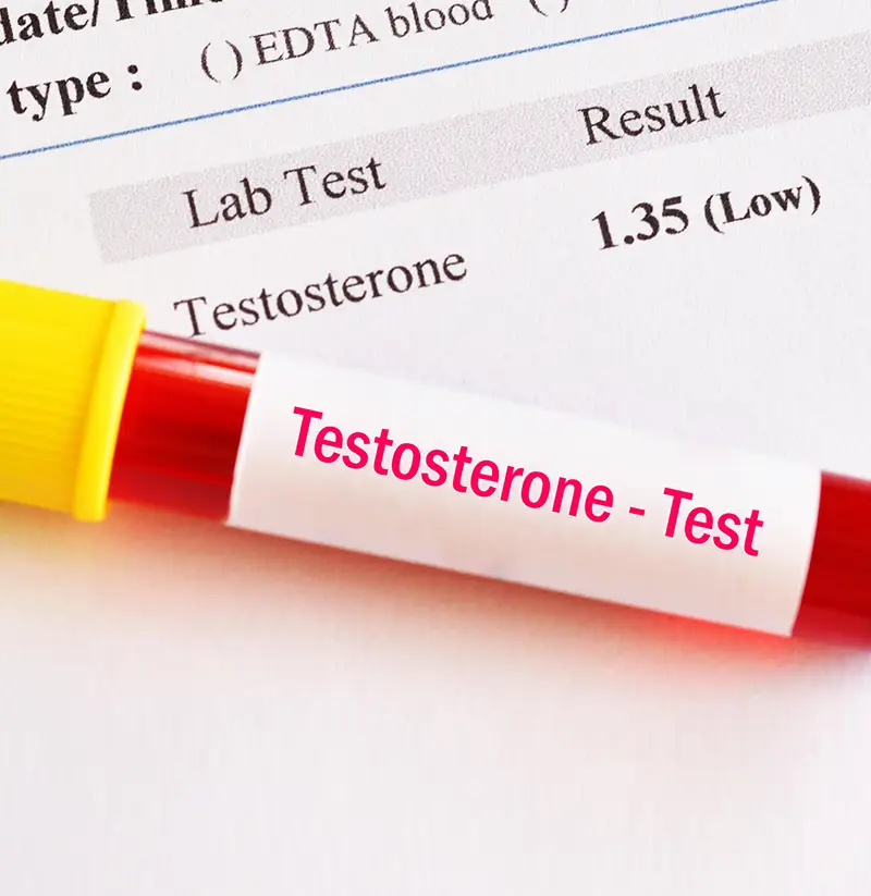 Natural Solutions for low Testosterone